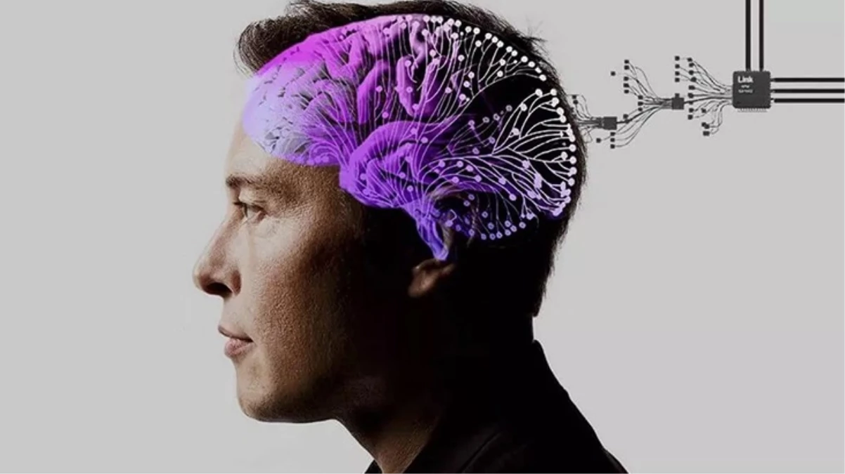 Elon Musk, beyin çipiyle bilgisayar faresinin kontrol edilebildiğini açıkladı