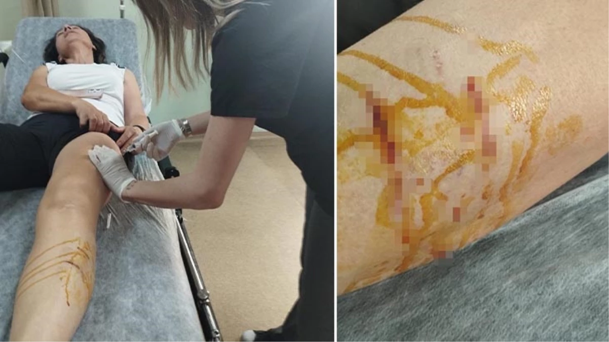 Talihsiz kadın başıboş köpeklerin saldırısında yaralandı