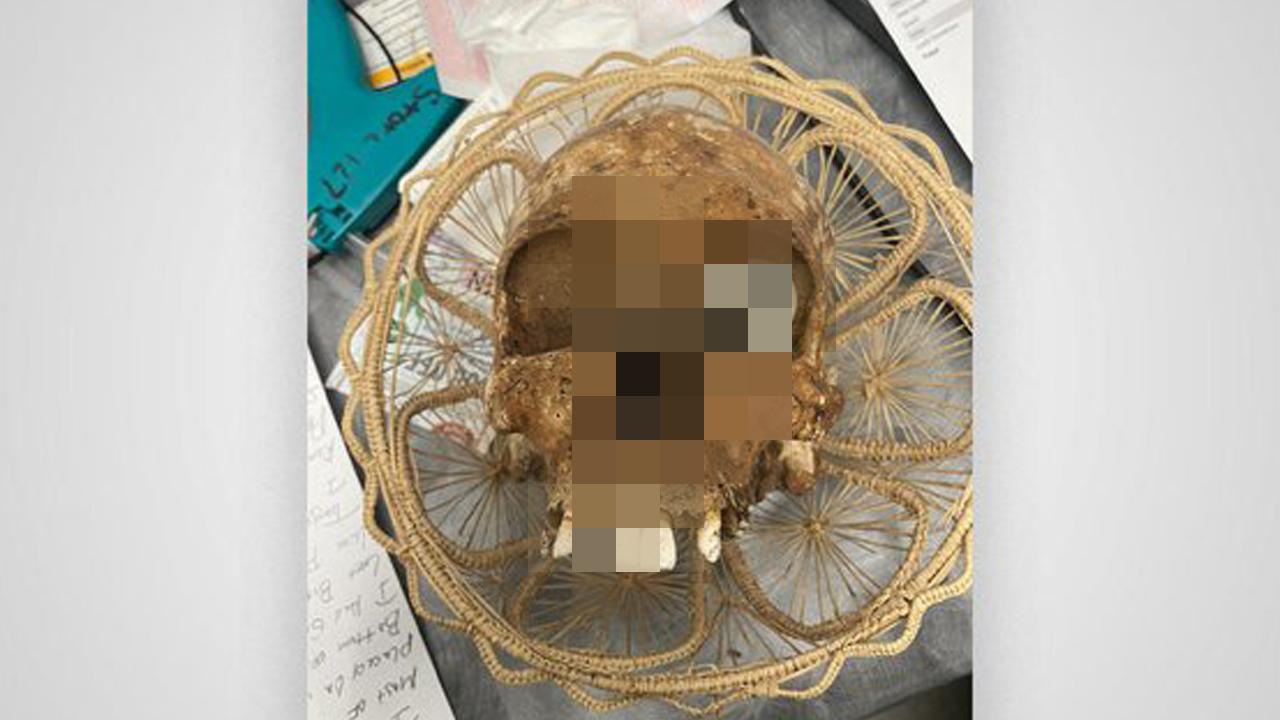 Akılalmaz olay! ABD’de bağış kutusundan insan kafatası çıktı