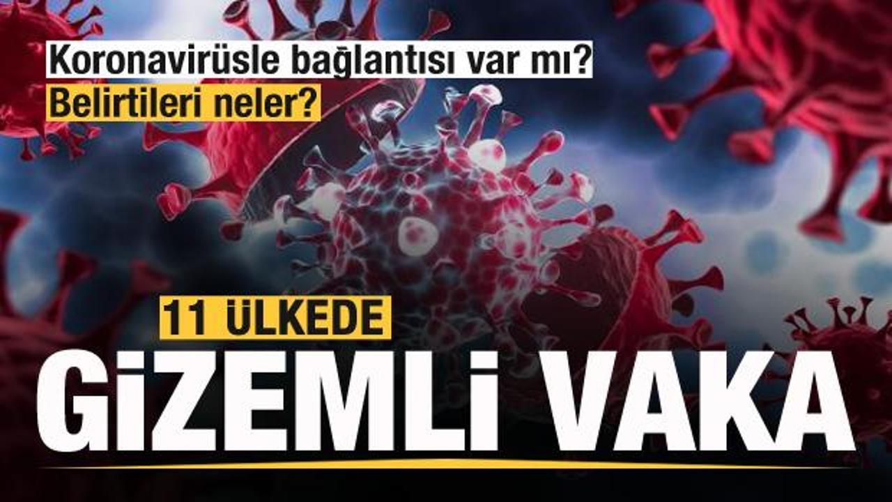 11 ülkede 169 gizemli vaka! Koronavirüsle bağlantısı var mı, belirtileri neler?