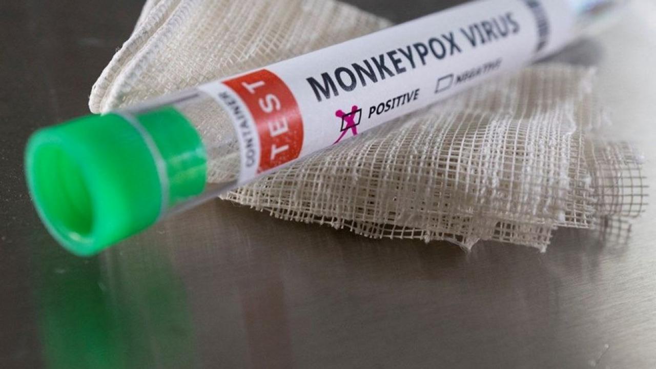 30 ülkede görüldü! Maymun çiçeğinde ilk yasak geldi