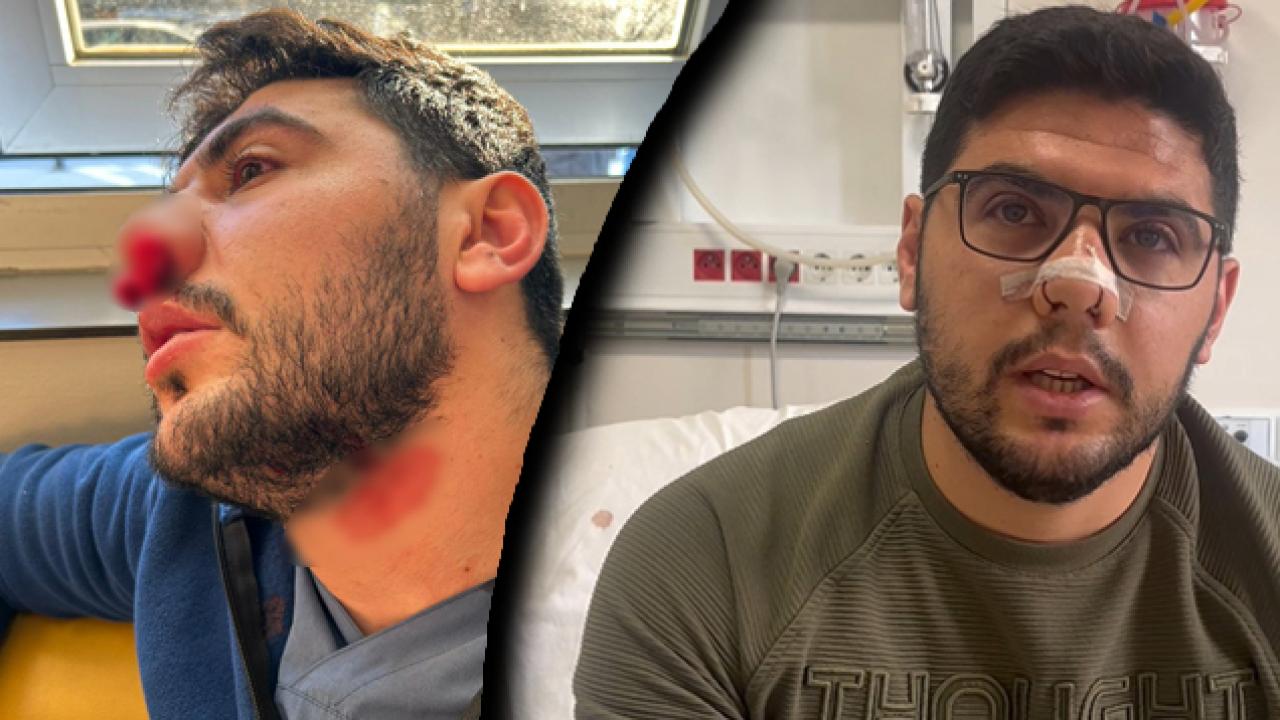 İstanbul’da hasta yakını dehşeti: Yumrukla saldırıp hemşireyi darp etti!