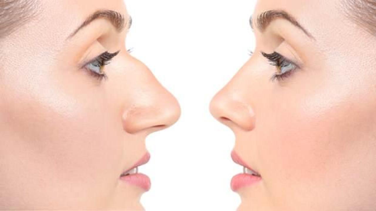 Toplumun yüzde 70-80’inde görülüyor: Burun eğriliği
