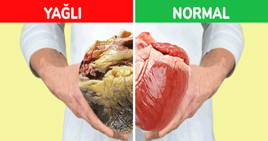 İç organ yağlanması ile nasıl mücadele edilir?