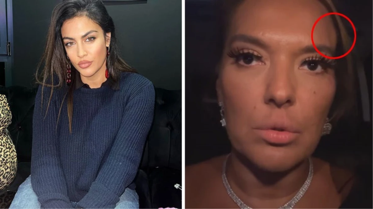 Demet Akalın’ın kaza geçirdiği olayda Tuğba Ekinci’nin tartışma yaratacak yorumu