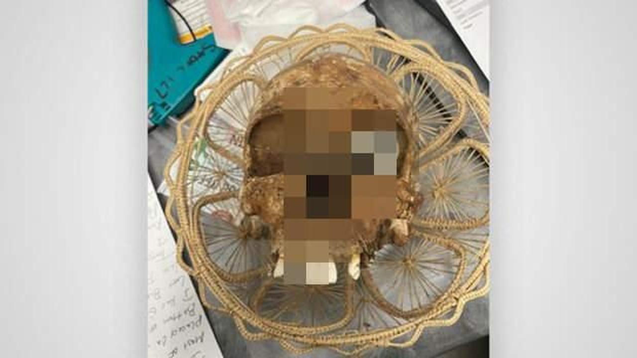 Akılalmaz olay! ABD’de bağış kutusundan insan kafatası çıktı