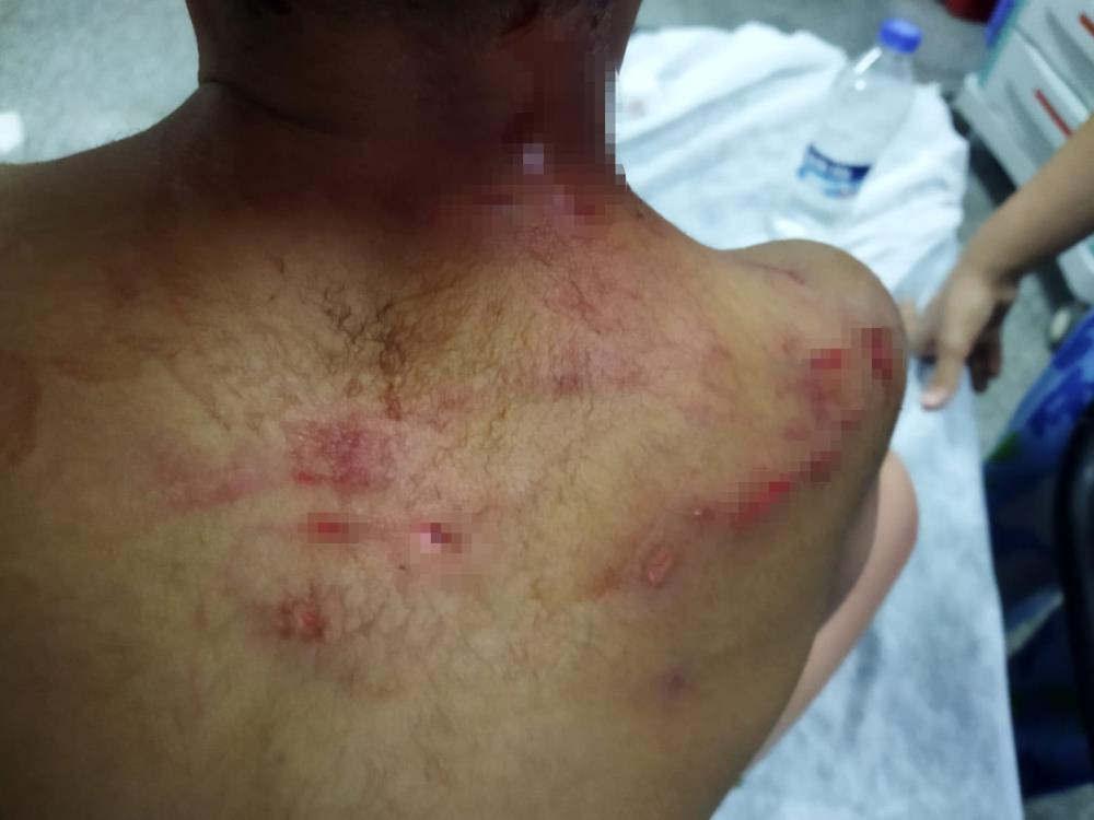 Bir köpek dehşeti daha! Çocuğun kafasına 25 dikiş atıldı...
