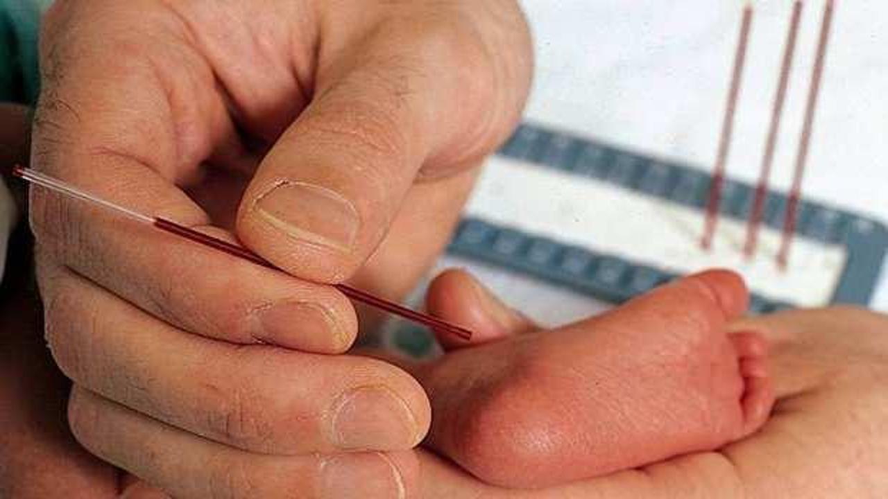 Fenilketonüri hastalığı nedir, belirtileri nelerdir? Bebeklerde fenilketonüri hastalığı belirtileri…