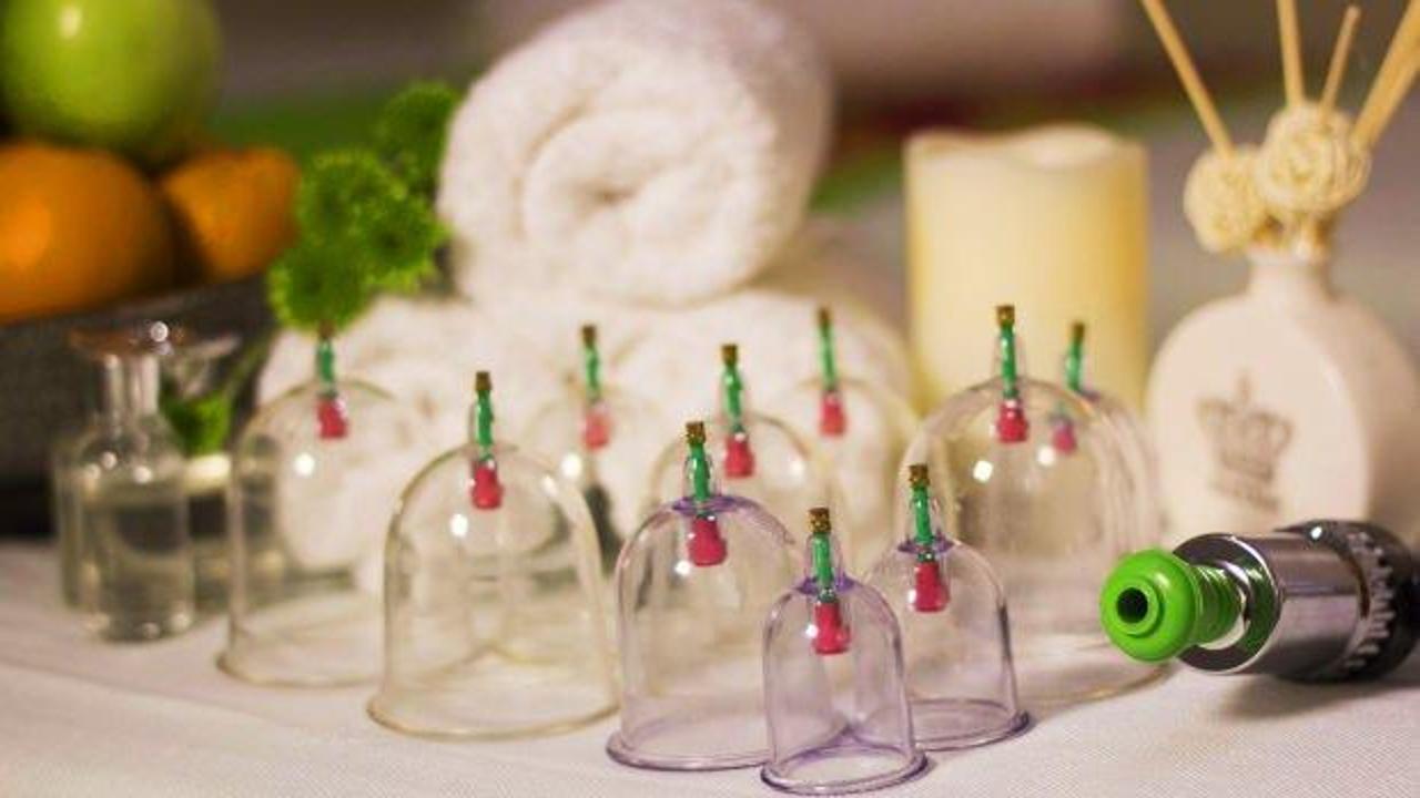 Hacamatın manevi sırları: Hacamat bölgeleri ve faydaları nelerdir? 2023 Hacamat takvimi..