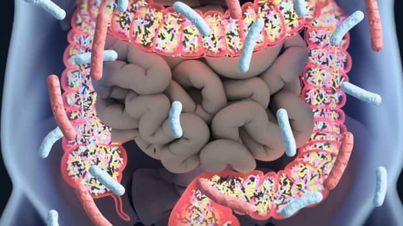 Kıl kurdu nasıl dökülür? Yetişkinlerde kıl kurdu belirtileri ve tedavisi…