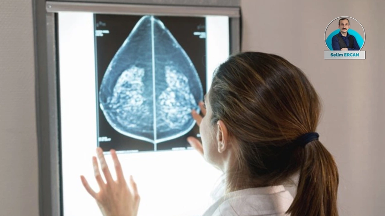 Meme kanserinde erken tanı hayat kurtarır