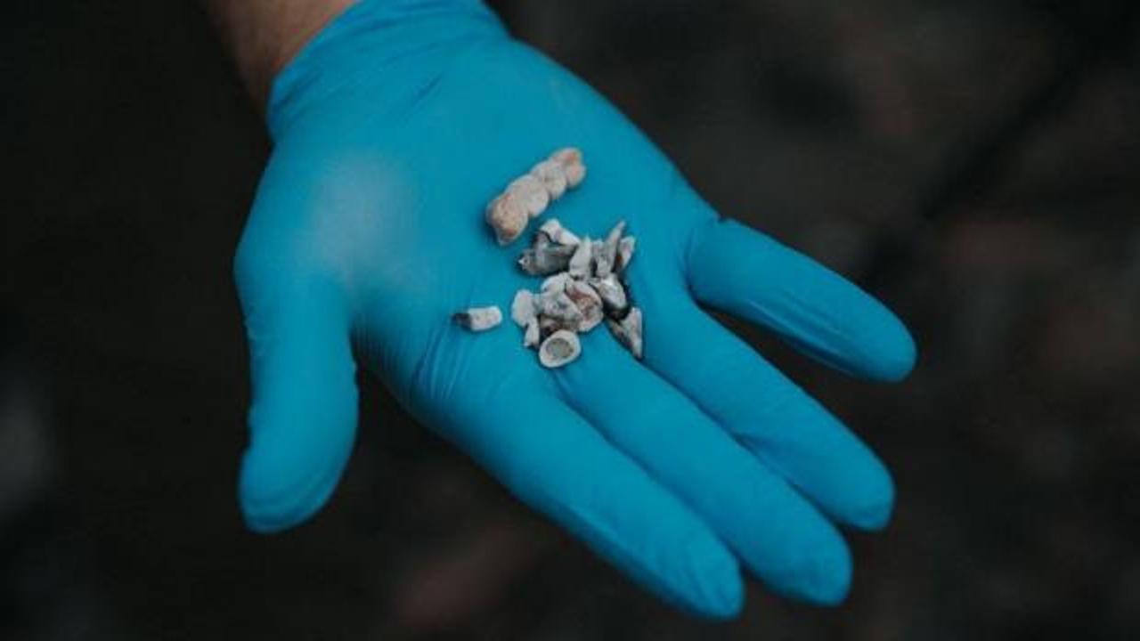 İsrail’in ‘yakılan çocukların dişi’ diye paylaştığı fotoğraf da sahte çıktı