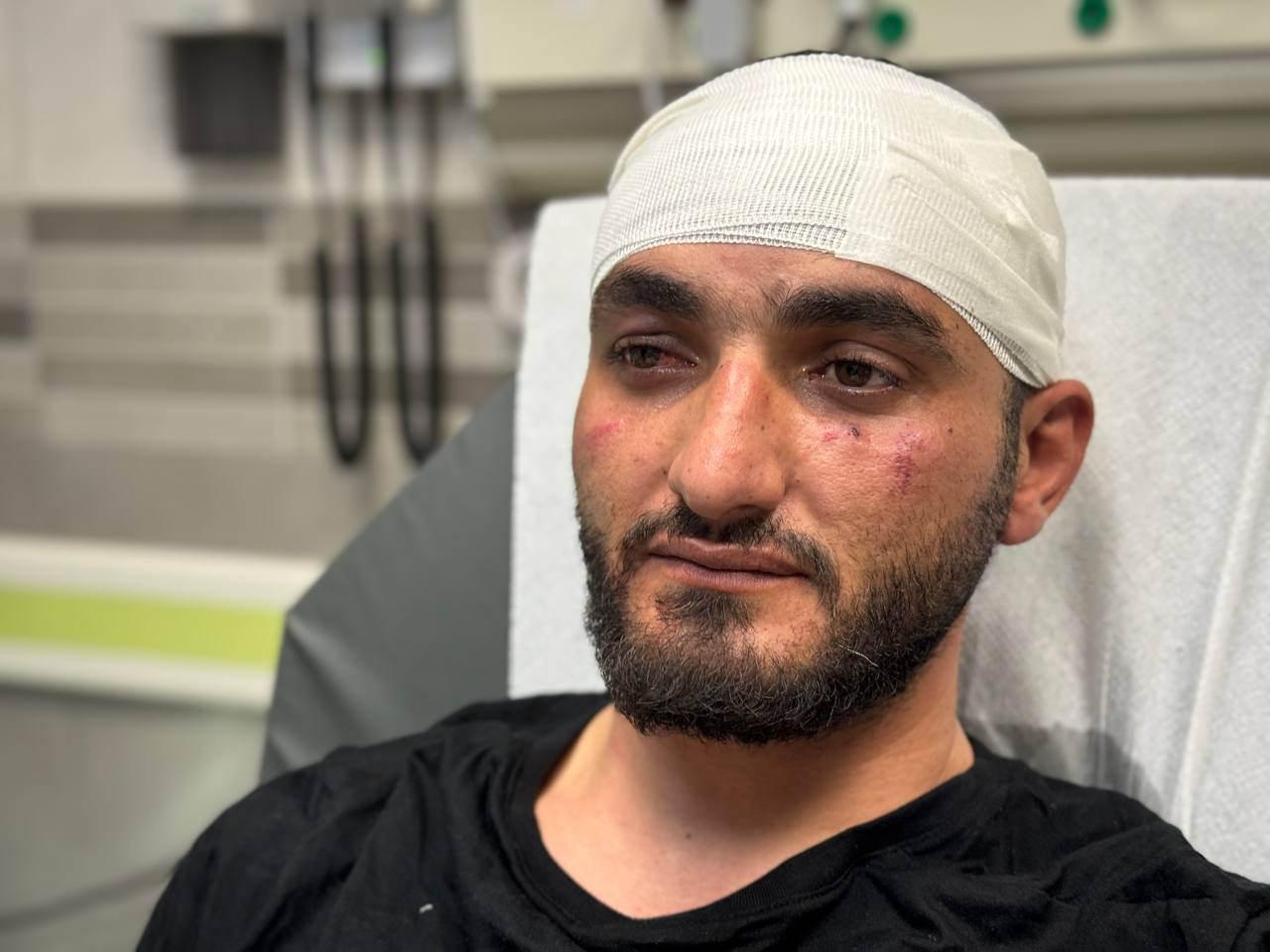 İsrail güçleri, AA foto muhabirini darp etmişti! BM'den son dakika İsrail açıklaması