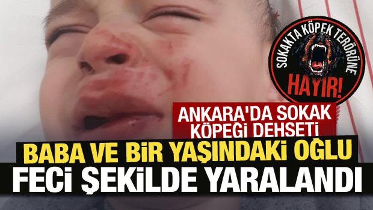 Ankara’da sokak köpeği dehşeti: Baba ve bir yaşındaki oğlu feci şekilde yarandı!