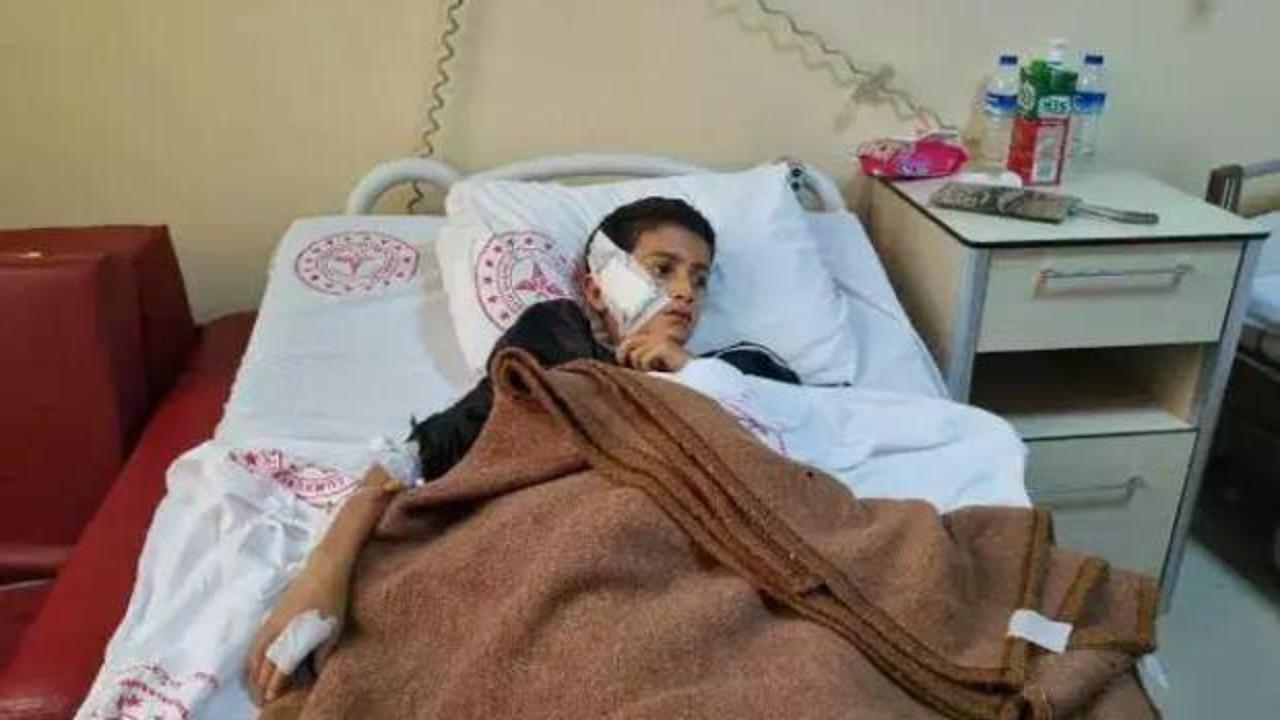 Diyarbakır’da sahipsiz köpeğin saldırdığı çocuk yaralandı