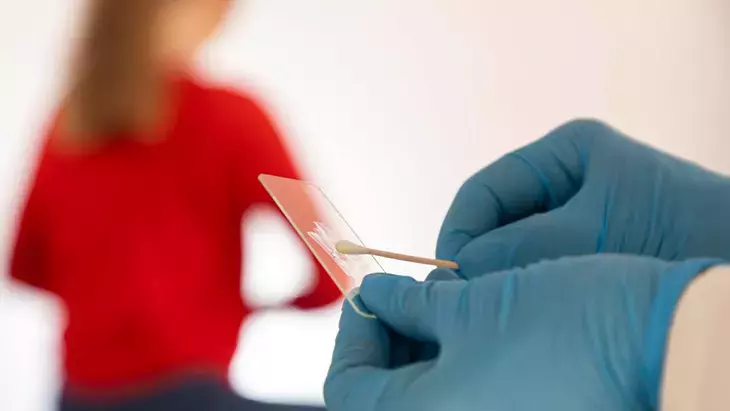 Her yıl 500 bin kadın rahim ağzı kanseri oluyor