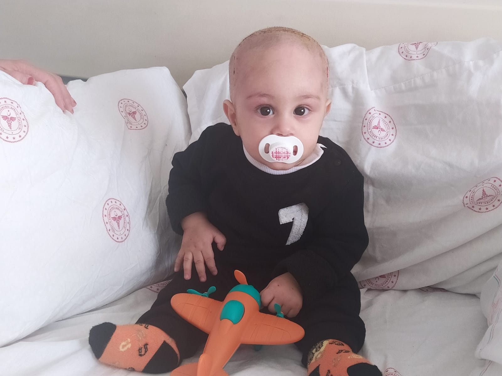 Van’da ilk defa 7 aylık bebeğe ‘trigonosefali’ düzeltme ameliyatı yapıldı