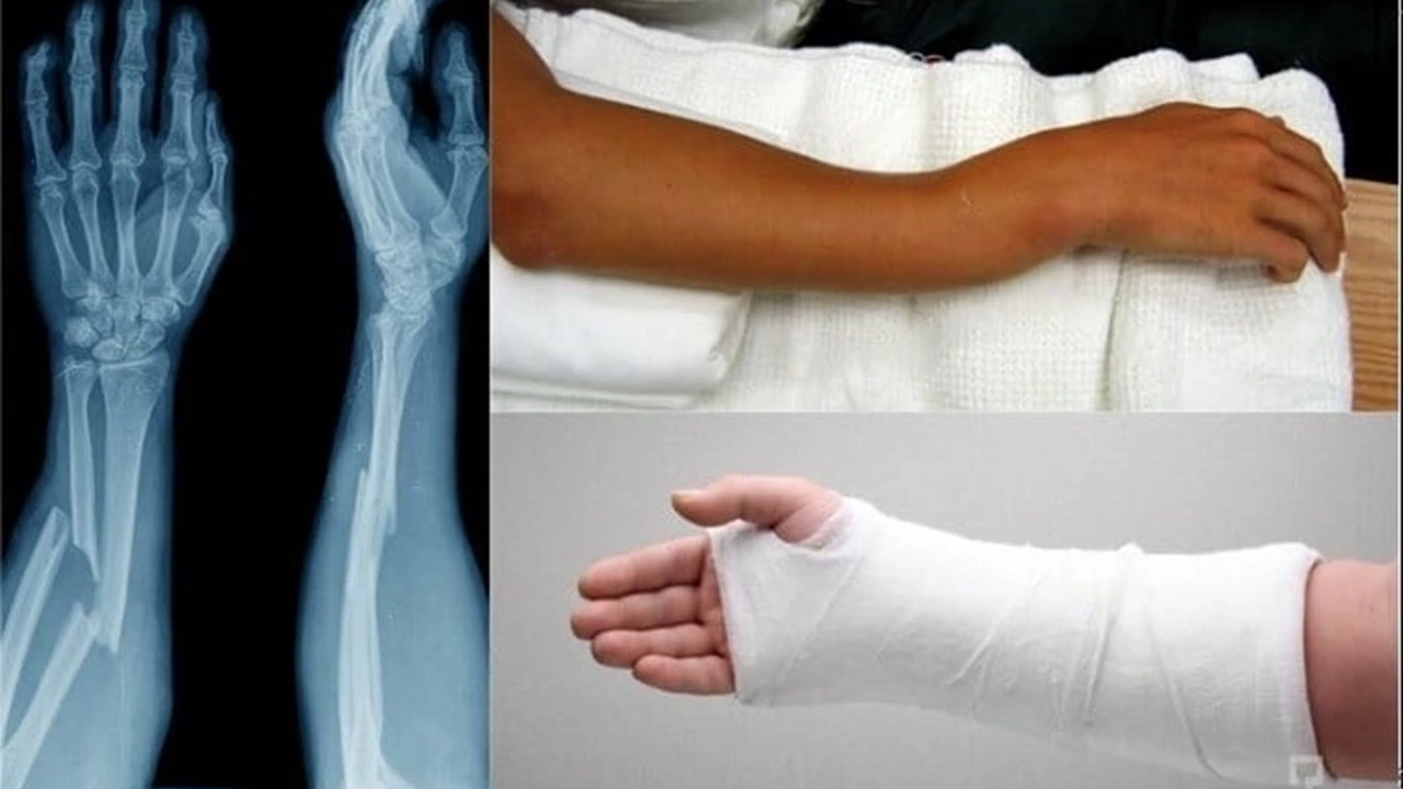 Uzmanlar, kış aylarında kırık vakalarına karşı uyardı