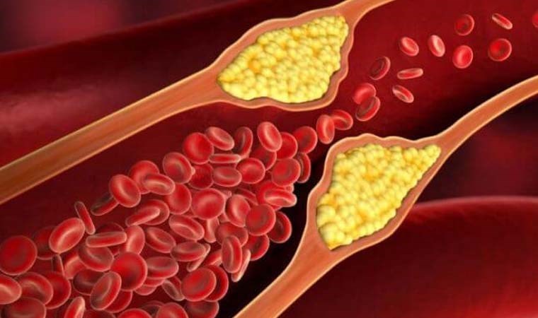 Kolesterol ne zaman tehlikeli olur?