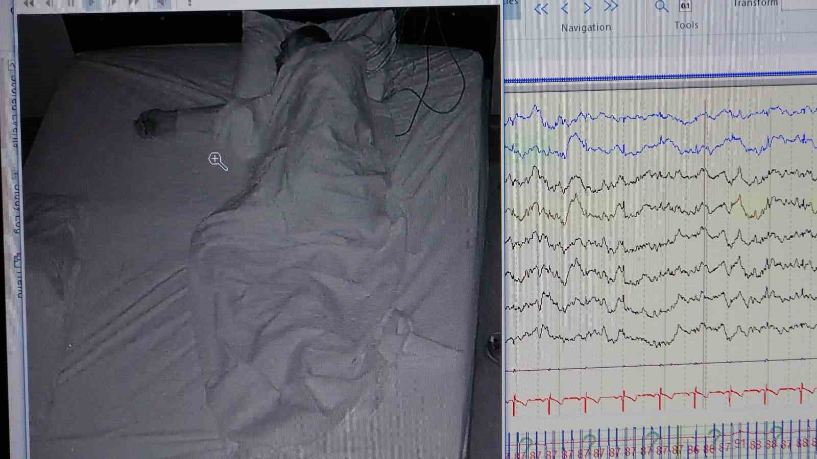 Klinik Nörofizyoloji Uzmanı Leba: “Uyku hastalığı kişinin ömrünü kısaltır”