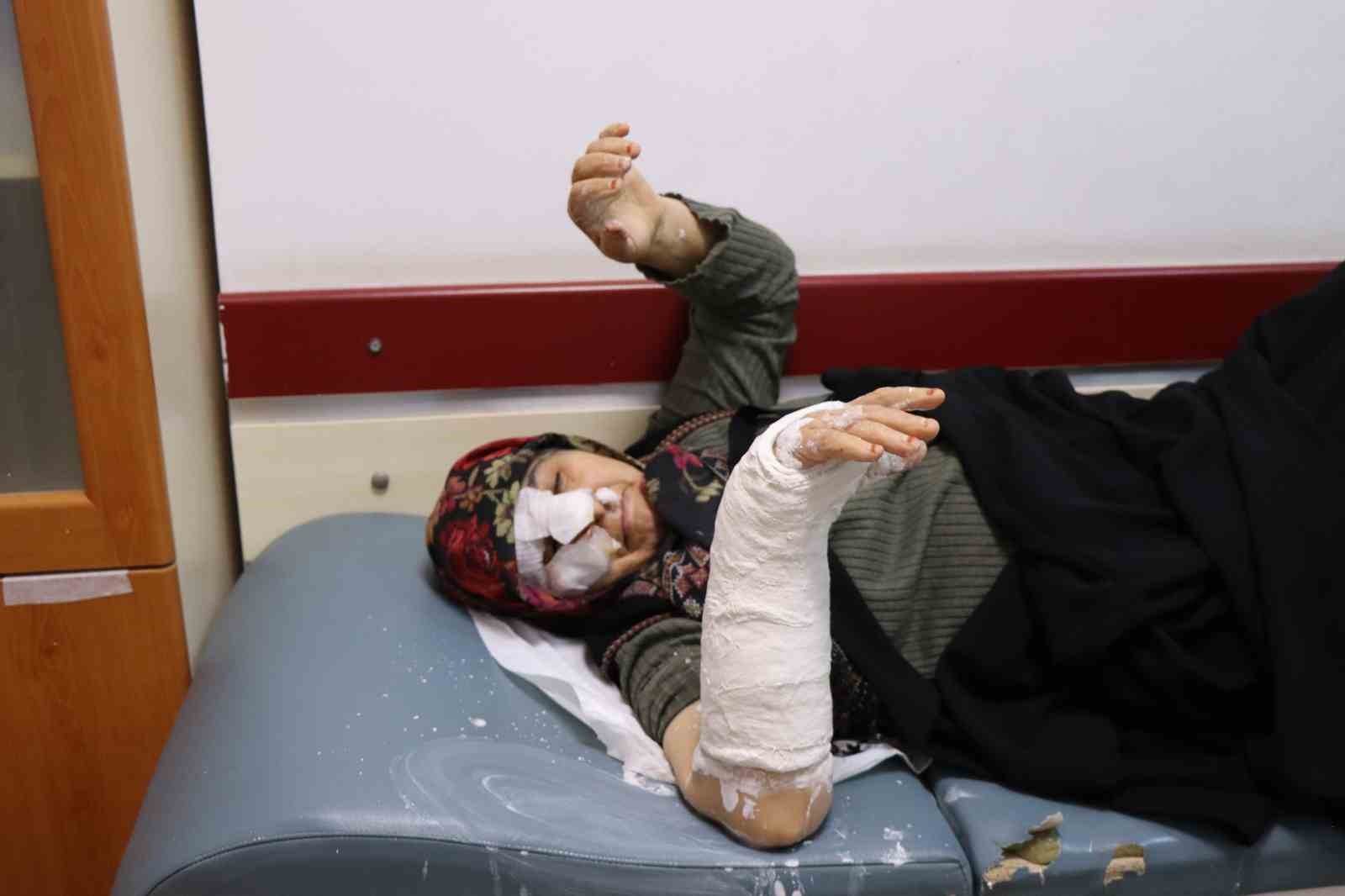 53 yaşındaki kadına saldıran sokak köpekleri dehşet saçtı