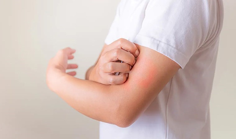 Hayalet hastalık ‘lyme’a dikkat