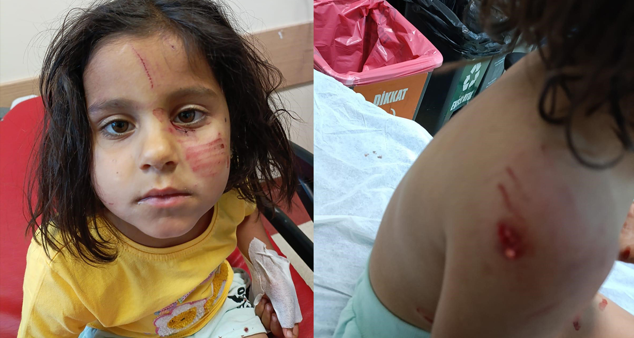 Başıboş köpekleri dehşet saçtı: Küçük çocuk yaralandı