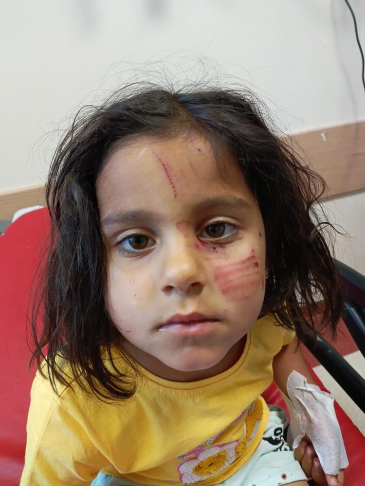 Başıboş sokak köpekleri dehşet saçmaya devam ediyor