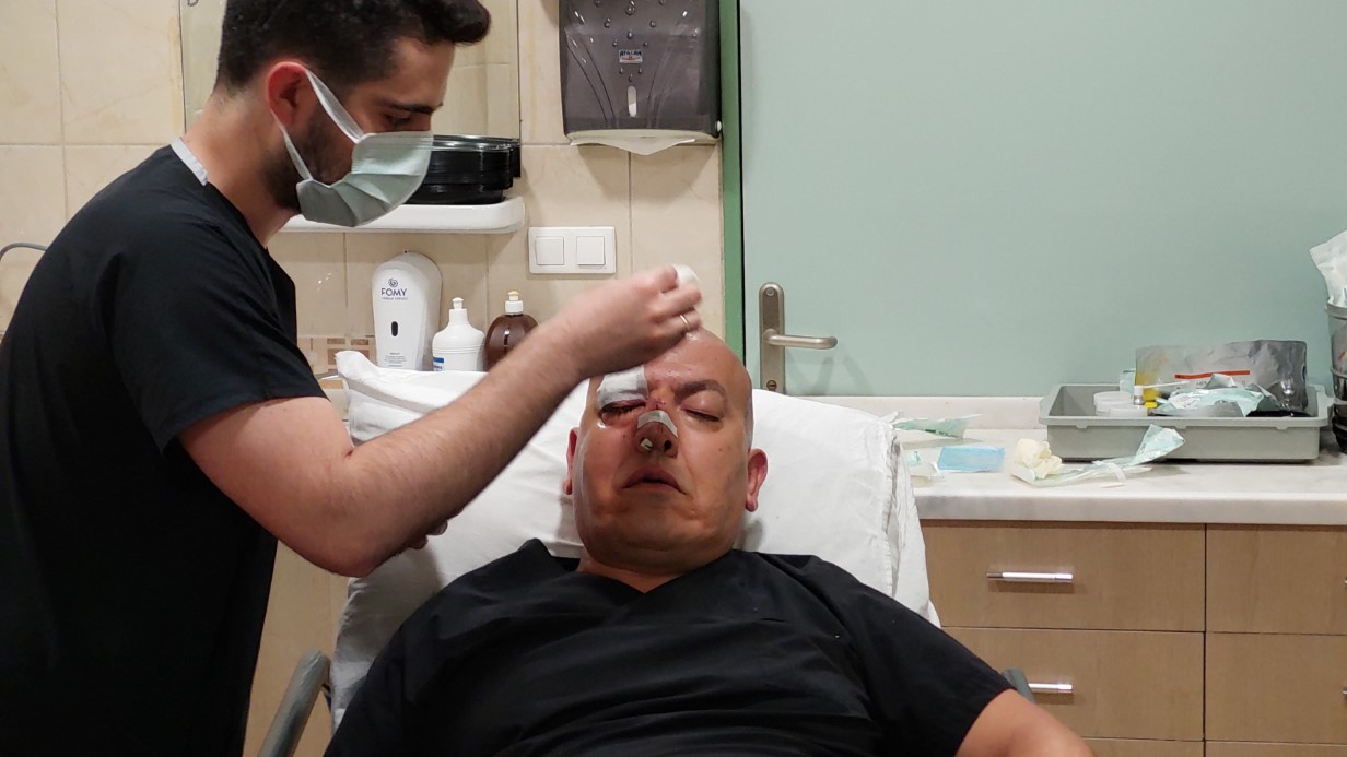 Hasta yakını doktorun burnunu kırdı