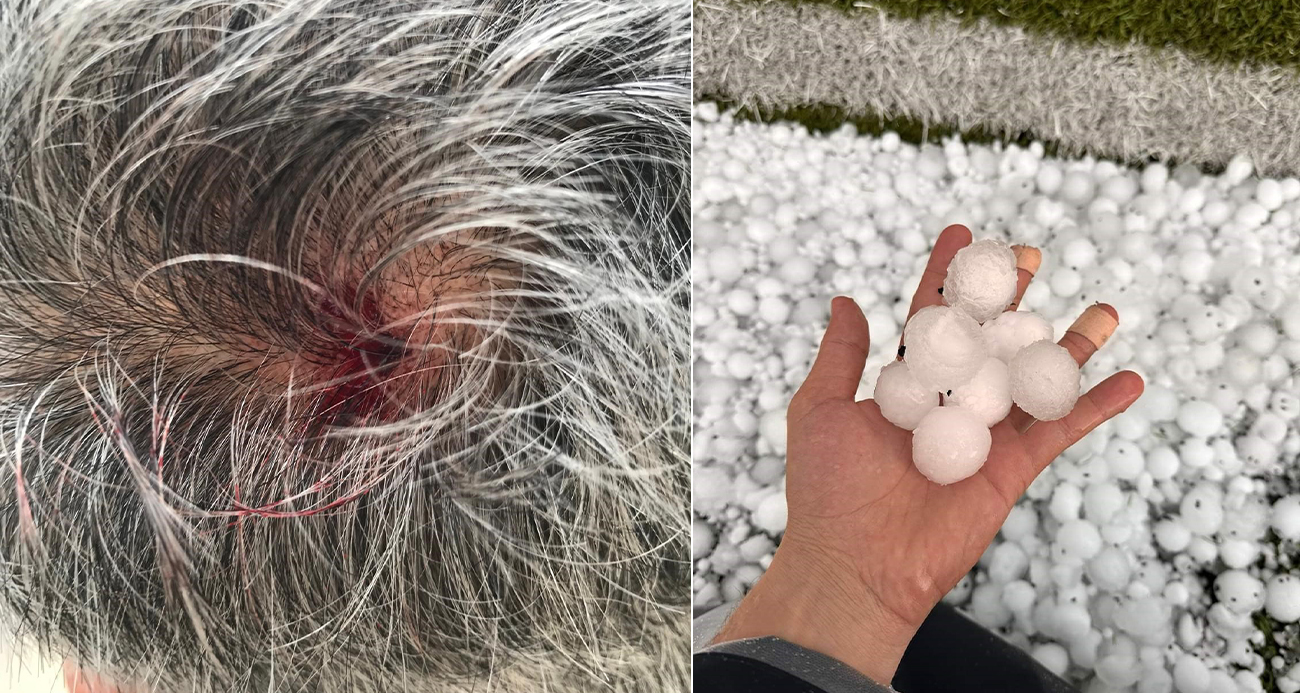 Ceviz büyüklüğündeki dolu vatandaşın kafasını yardı