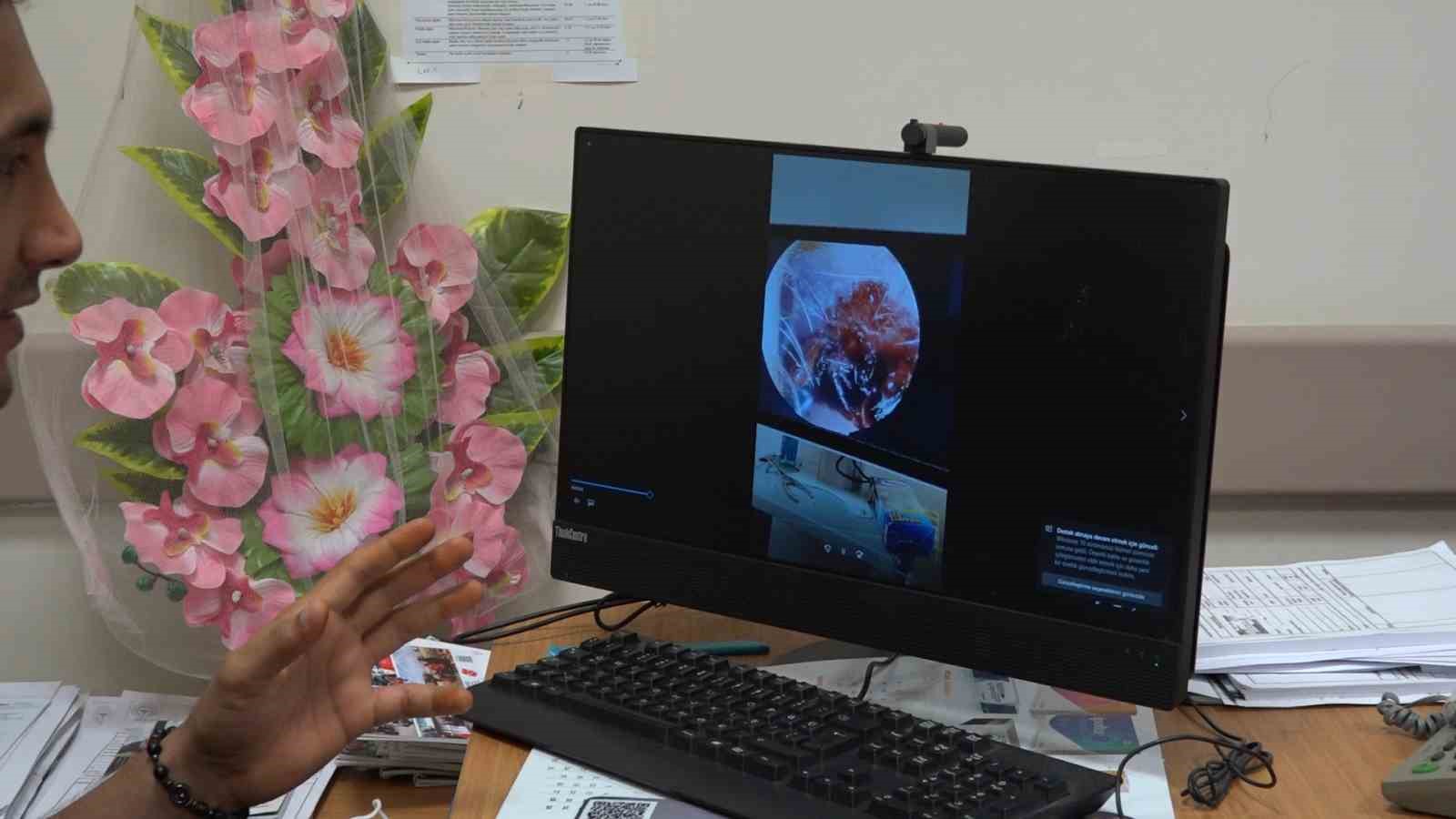 70 yaşındaki kadının kulağına  kene girdi