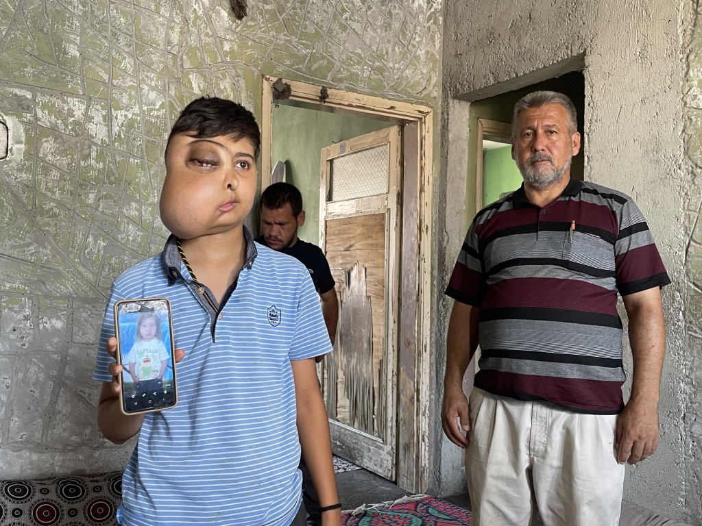 İki farklı yüzü var gibi görünen çocuğun tek isteği iyileşip gülmek