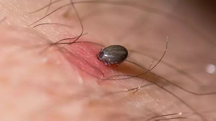 Dikkat! ‘Göz kapağını ısıran kene, görme kaybına yol açabilir’
