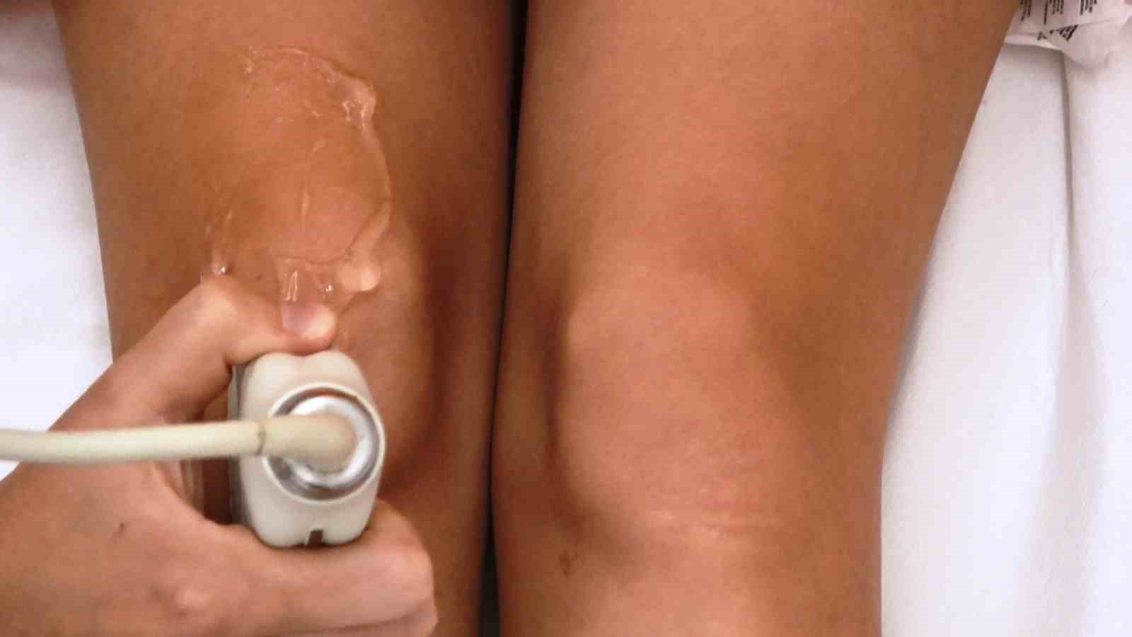 Kireçlenmeye göbek kordonu çözümü