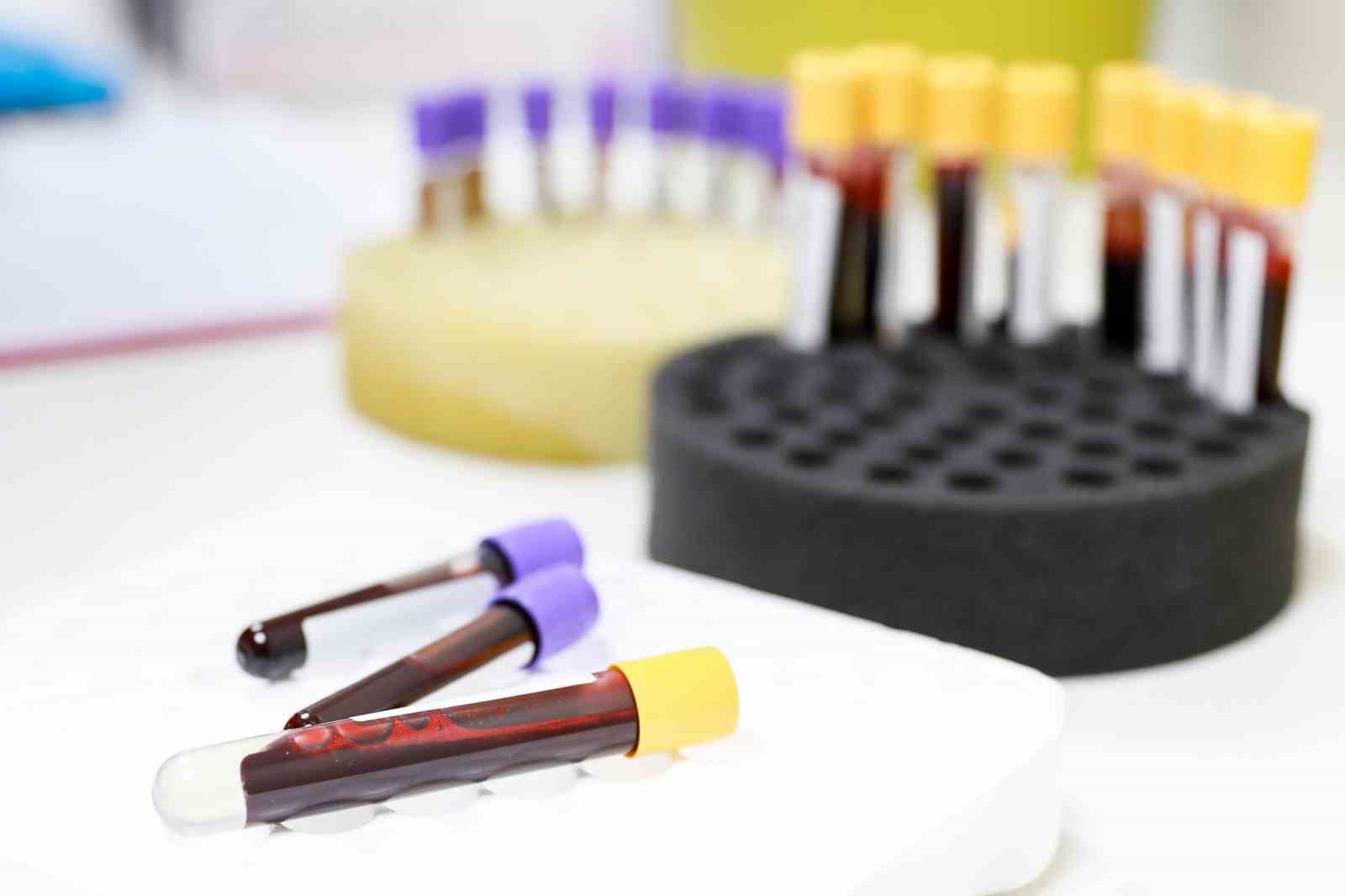 Türk Kızılayı, nakil bekleyen hastalara umut oluyor