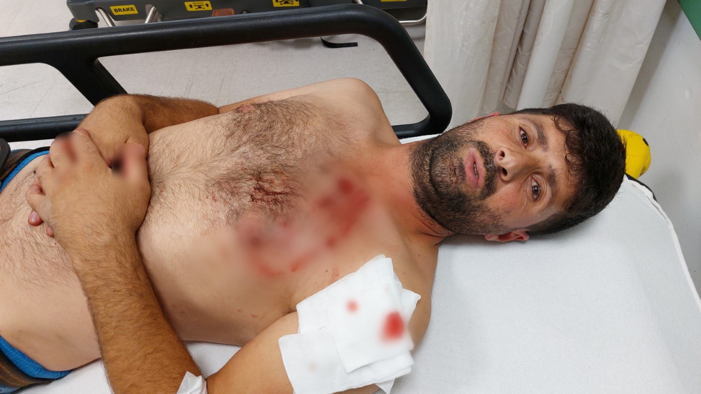 Köpeğin saldırısına uğrayan şahıs ölümden döndü