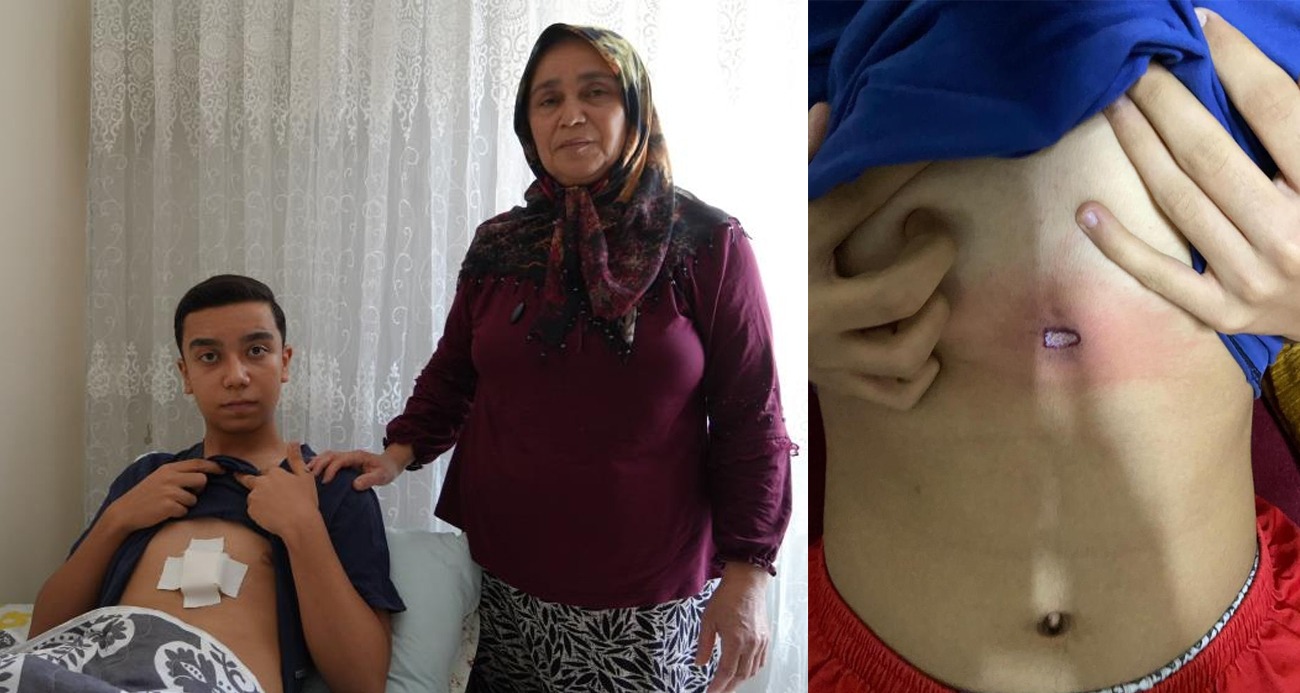 Yorgun mermi, damda oturan 16 yaşındaki Mertcan’a isabet etti