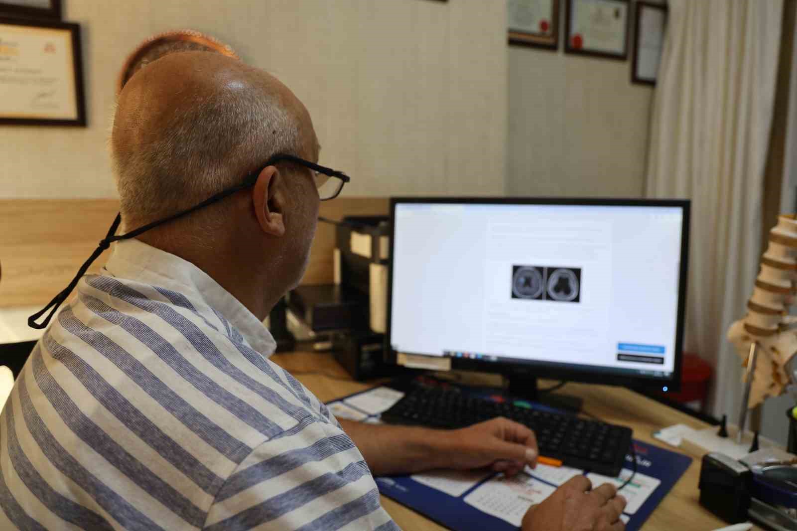 Dikkat! Hidrosefali, erken teşhis konulmazsa ölüme sebebiyet verebilir