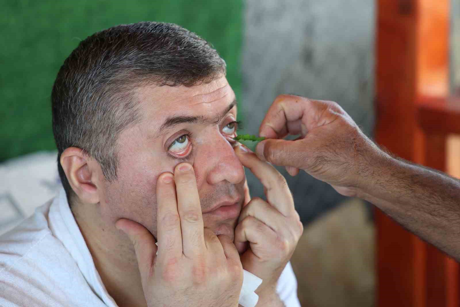 Kırlangıç otu ile göz hastalıklarına umut