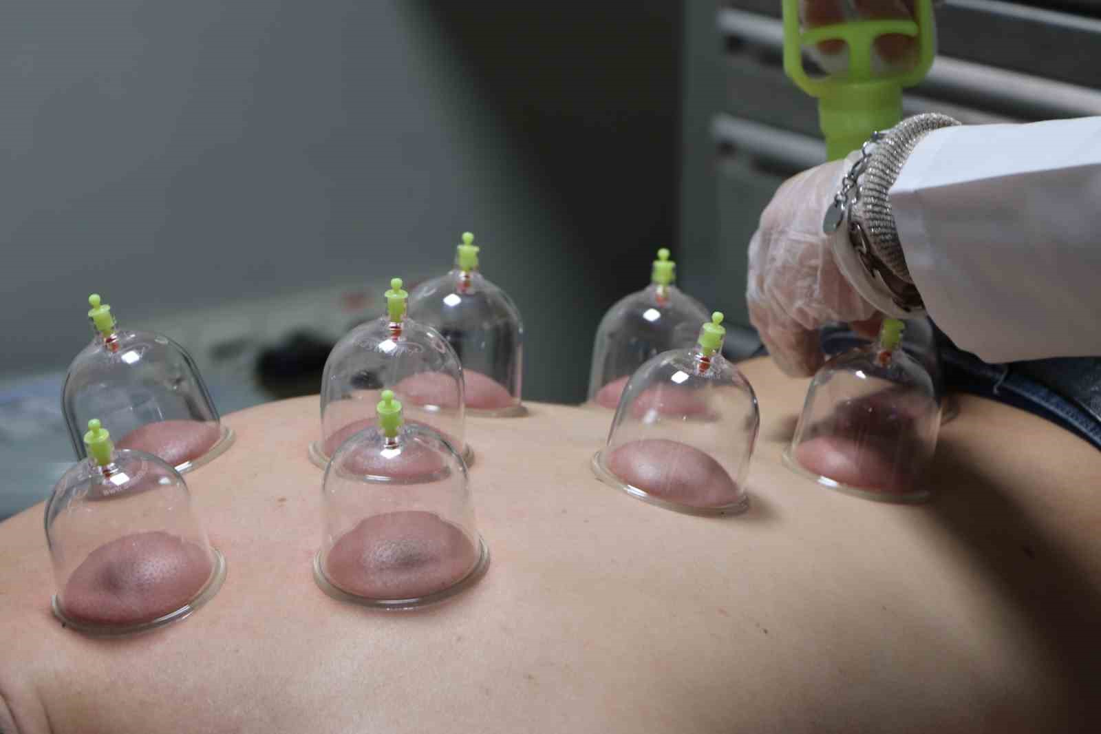 Yanlış uygulanan hacamata dikkat! “Ömür boyu geçmeyen yaralar ve ağrılar oluşturuyor”