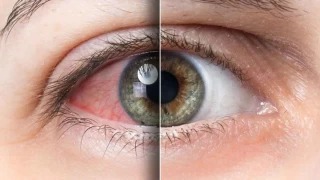 Dikkat! Göz damarlarındaki tıkanmalar, ani görme kaybına yol açabilir