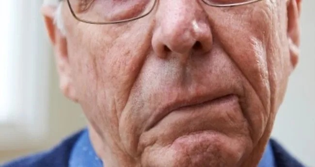 Sağlık Bakanlığından inme uyarısı