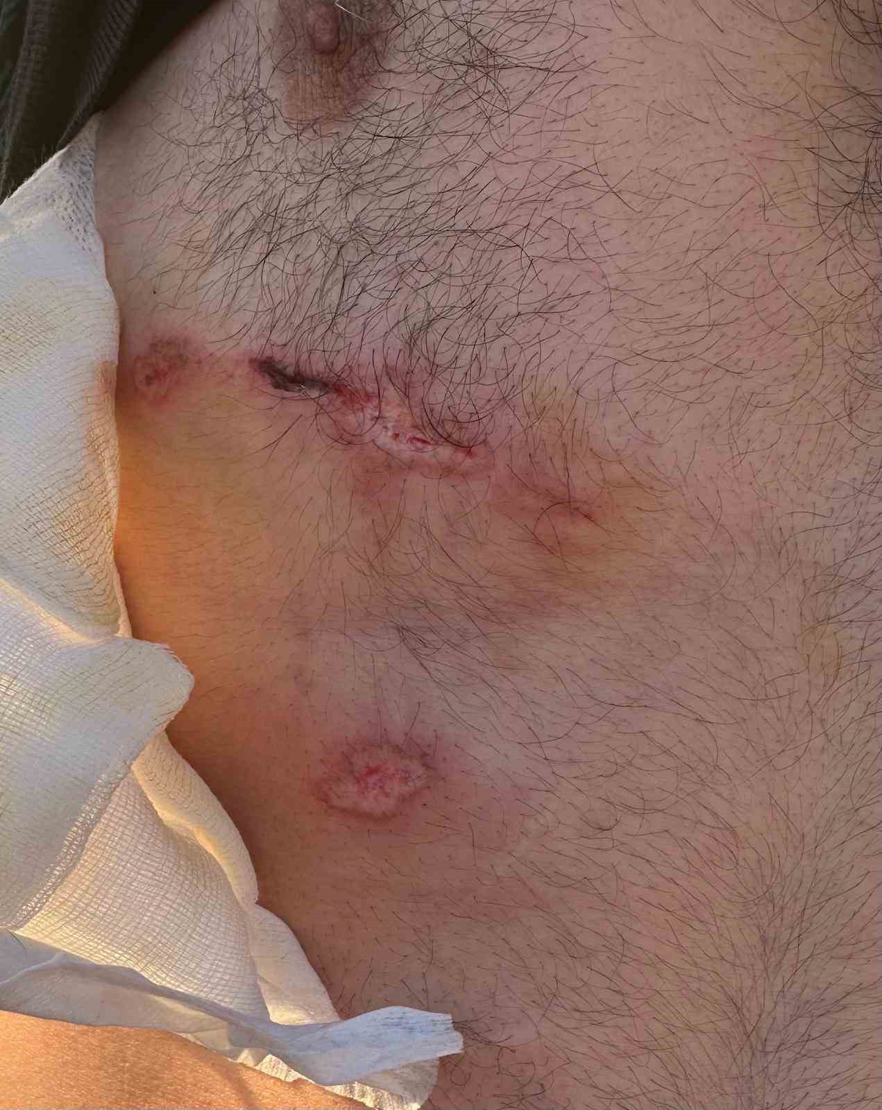 Abdest almaya giderken ayı saldırısına uğradı