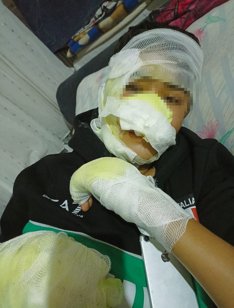 Fırına kilitlenen 16 yaşındaki çocuk yandı