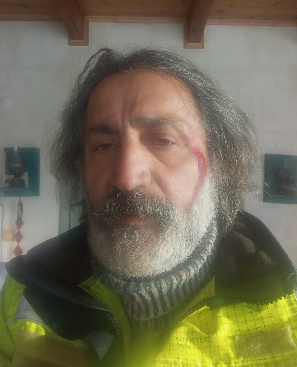 Kurt saldırısına uğrayan adam, köpekleri sayesinde kurtuldu