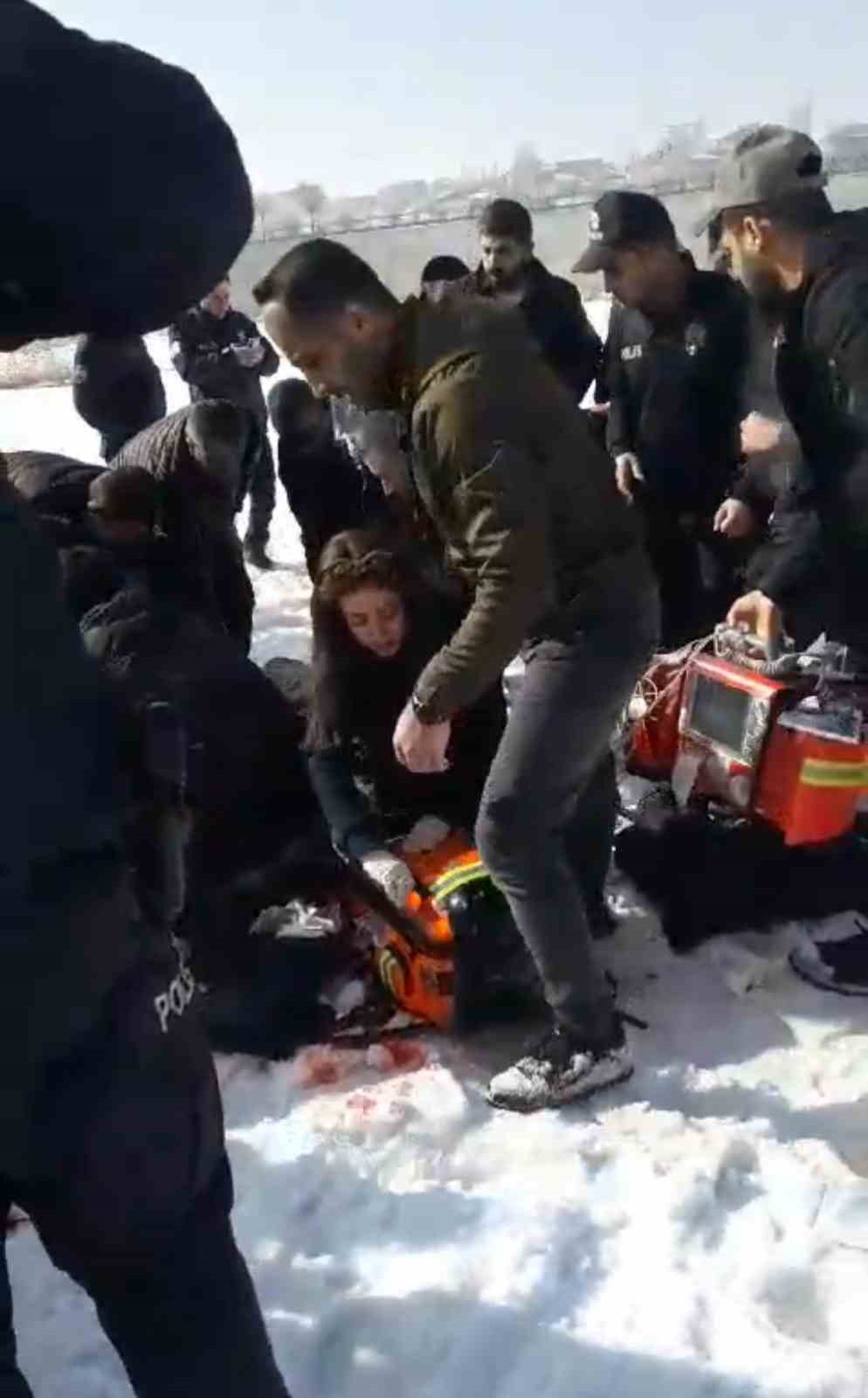 Başıboş köpekler 12 yaşındaki kız çocuğunu ağır yaraladı