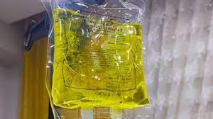 Sarı Serum Nedir? Neden Çok Tercih Ediliyor? Sağlığa Zararlı mı?