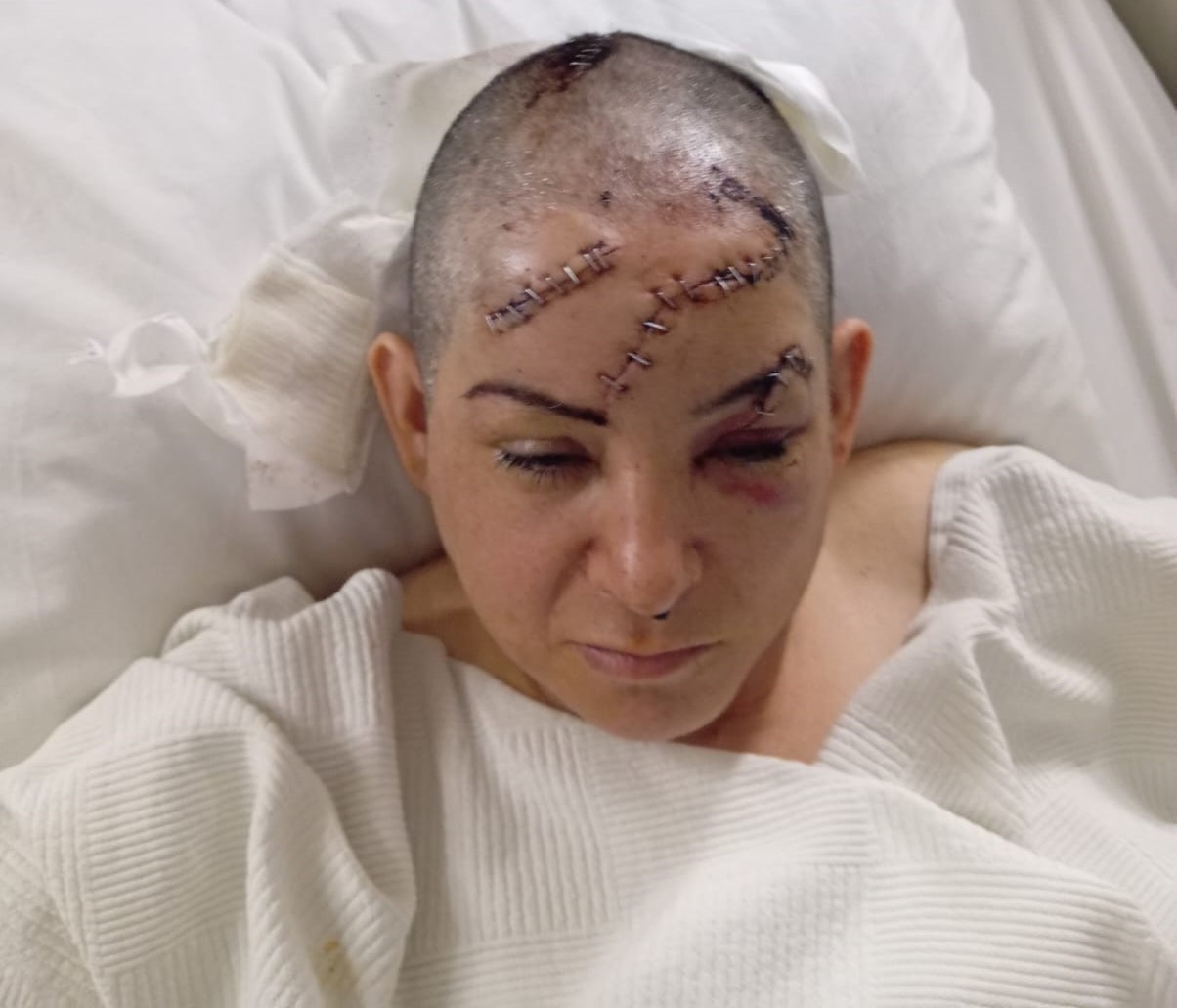 Eşinin satırla ağır yaraladığı kadın yaşadığı dehşeti anlattı