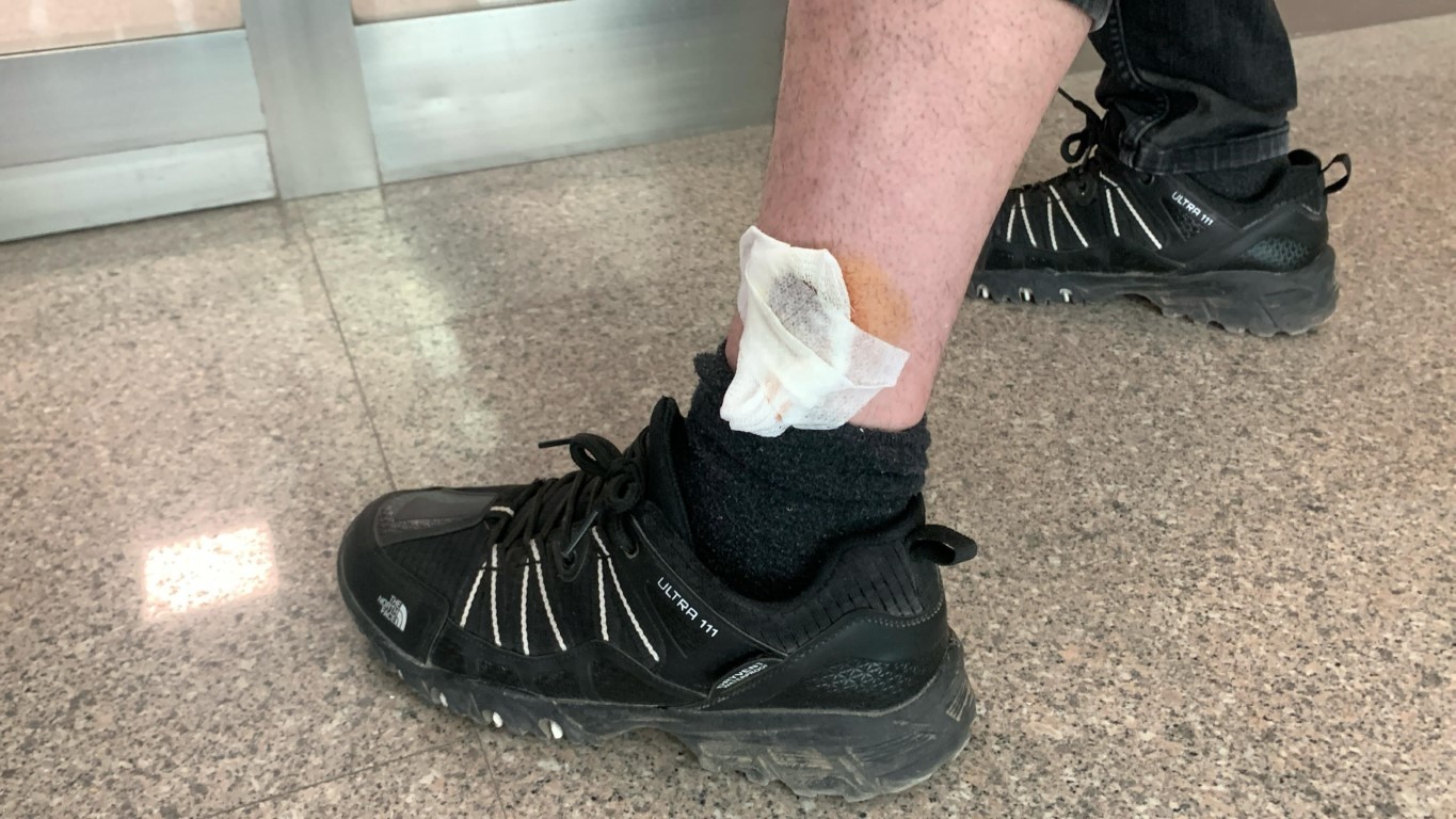 Köpeğin saldırısından oğlunu kurtarmak isteyen baba yaralandı