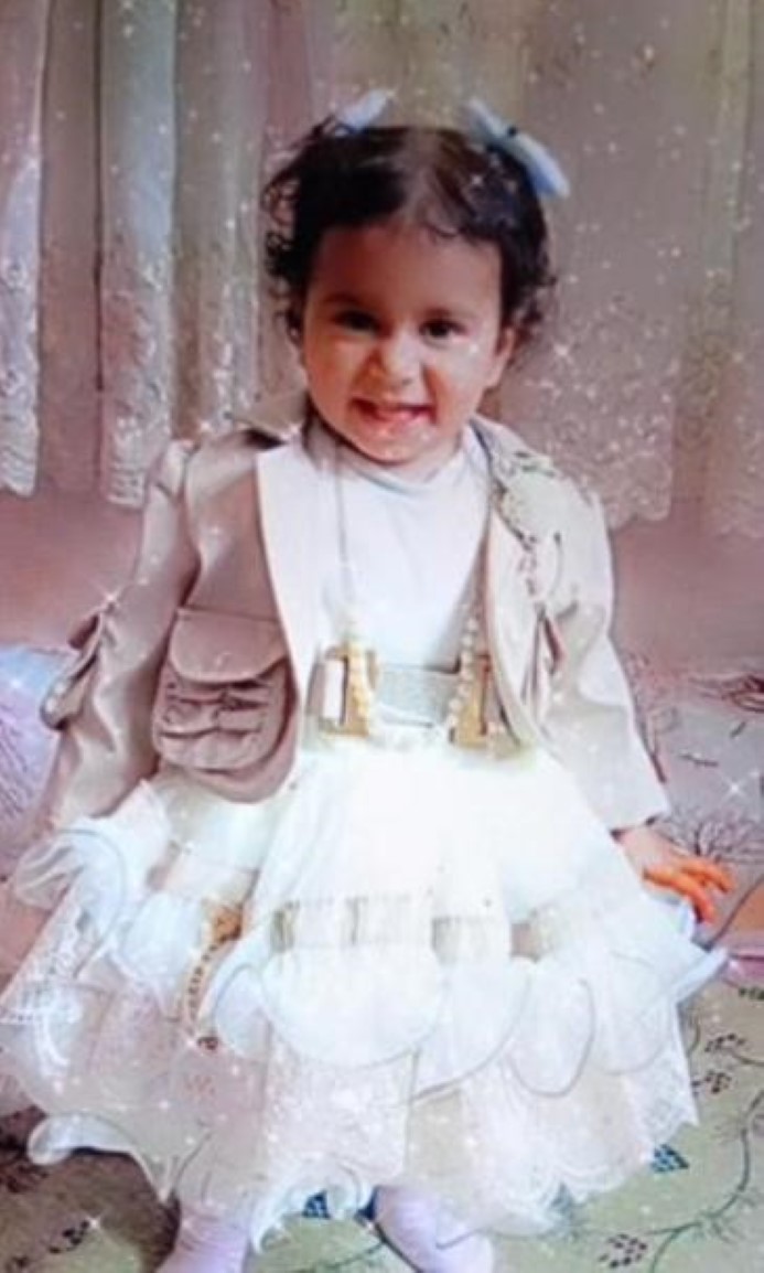 Köpek saldırısına uğrayan 2 yaşındaki çocuk hayatını kaybetti